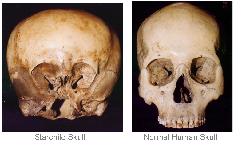 Starchild Skull vs human skull